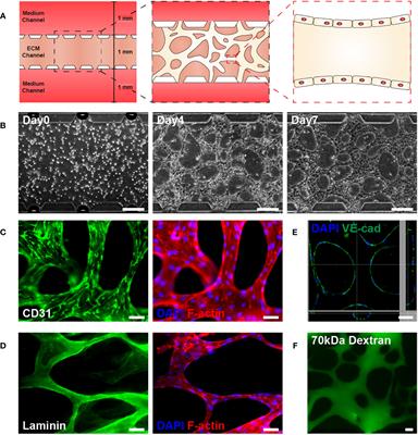 Radiation induces acute and subacute vascular regression in a three-dimensional microvasculature model